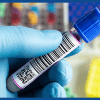 barcode label on laboratory vial