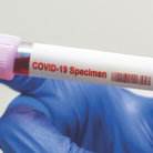 Coronavirus blood test .  Coronavirus positive blood in laboratory. 2019-nCoV Coronavirus originating in Wuhan, China