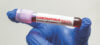 Coronavirus test tube label